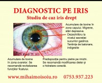 Diagnostic pe iris
