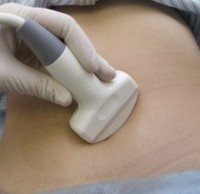 ECOGRAFII ABDOMINALE ECOGRAFII ABDOMINALE