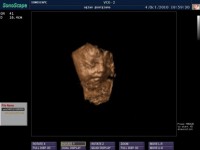 Ecografie 4D Ecografie 4D