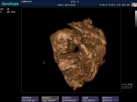 Ecografie 4D Ecografie 4D