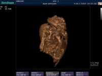 Ecografie 4D Ecografie 4D